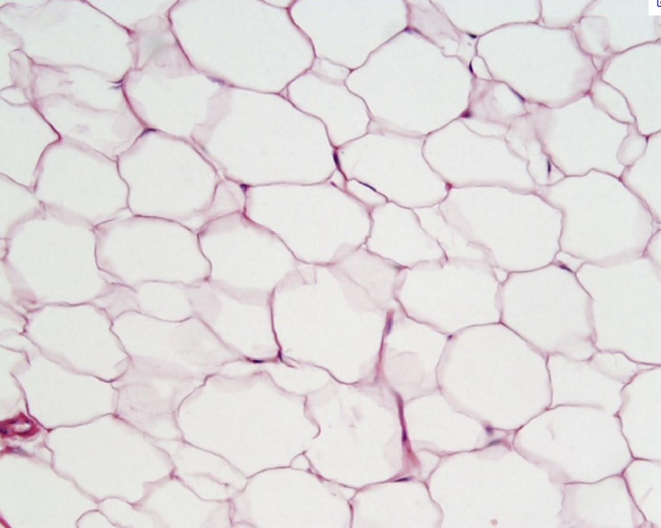 <p>Adipose tissue</p>