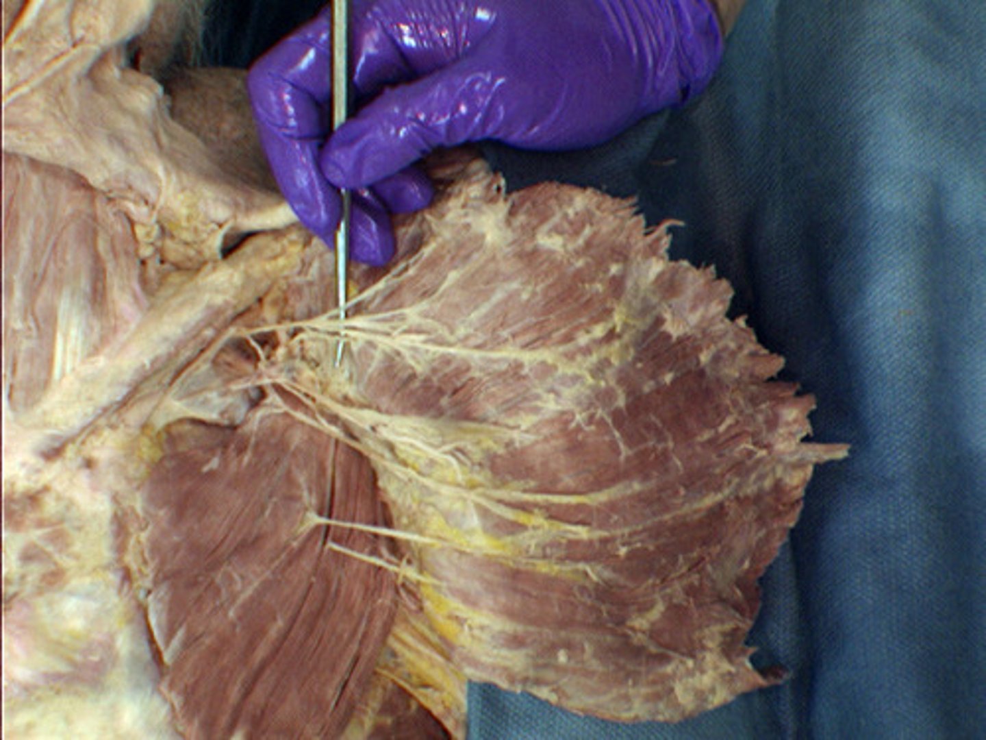 <p>superior to the medial</p>