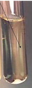 <p>What physical nature of culture media is this? is it Turbid or Clear?</p>