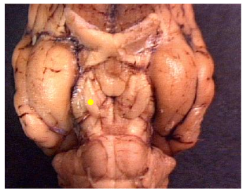 <p>Name the part of the brain marked by the yellow dot.</p>