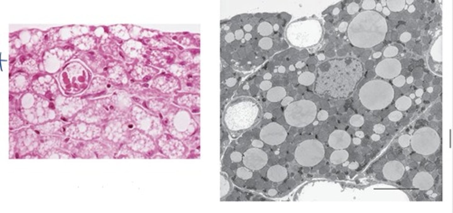 <p>What adipose tissue is this?</p>
