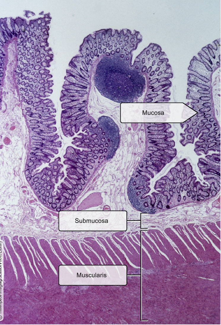 <p>Mucosa- <span>simple columnar epithelium</span></p>