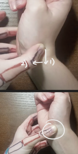 <ul><li><p>palpate for the trapezium (find end of 1st metacarpal, and slide down until you reach a divot) </p><ul><li><p>draw proximal a bit</p><ul><li><p>then a little ulnar </p></li></ul></li></ul></li></ul><p></p>
