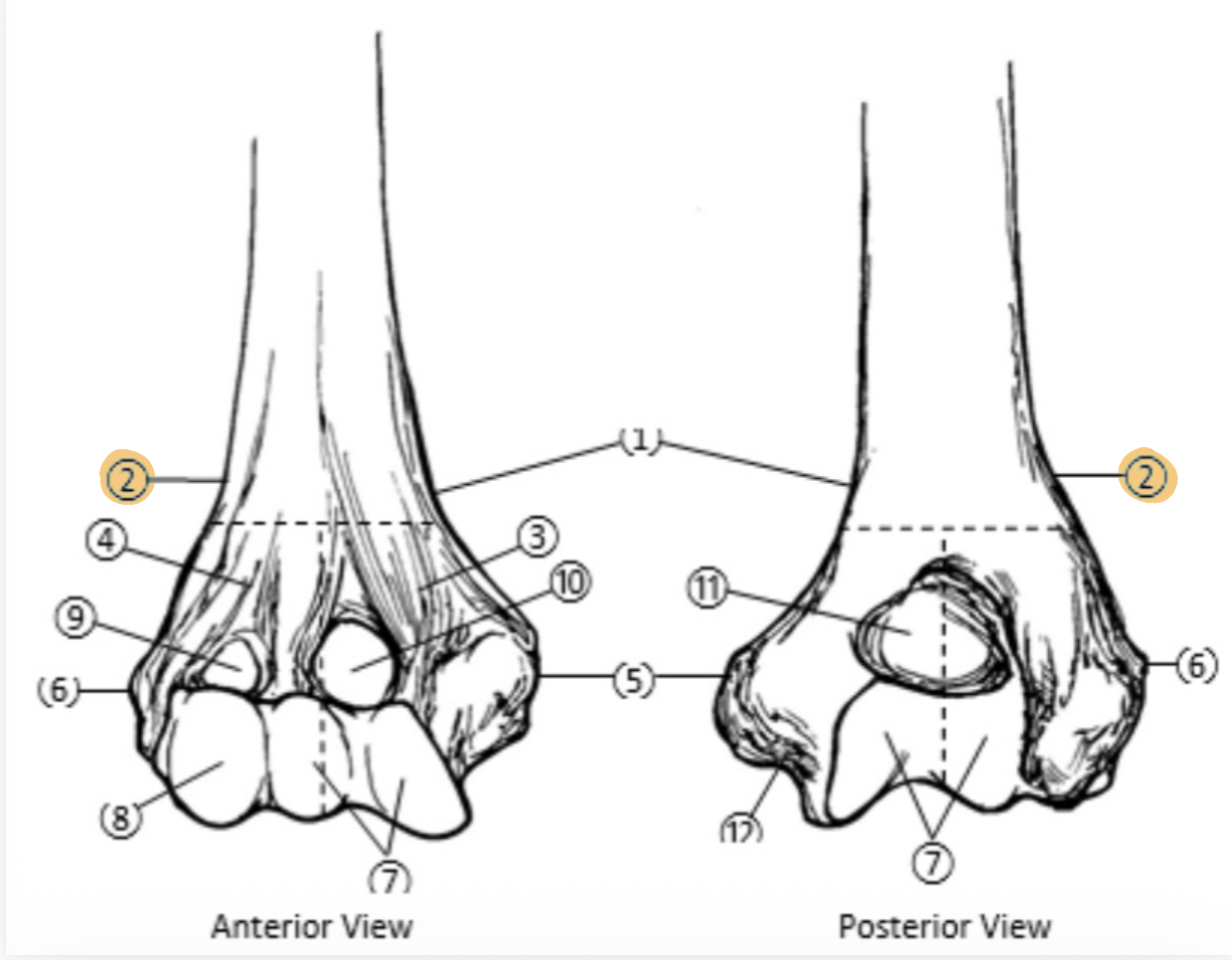 <p>(forearm&hand) On the Distal end of the Humerus, which part is highlighted (2)?</p>