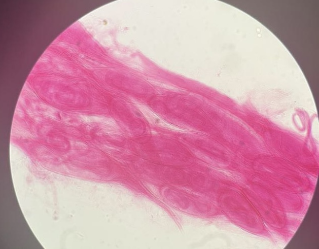 <p>What nematoda is displayed in the pork muscle?</p>