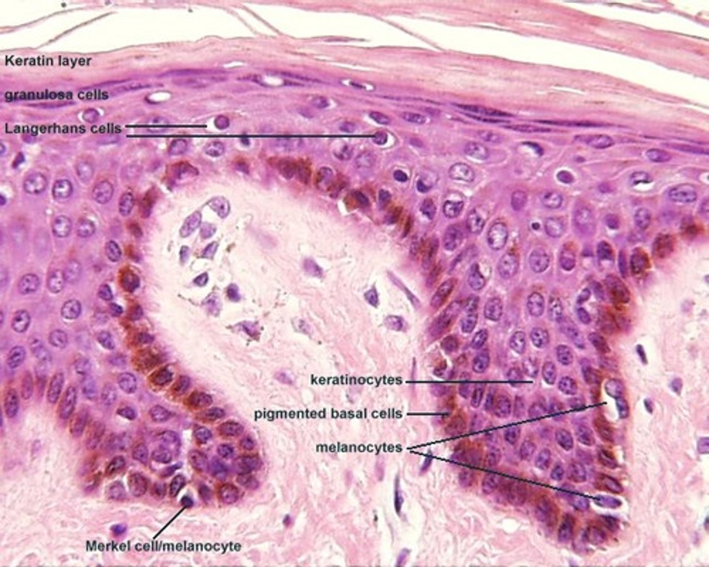 <p>Keratinocytes</p>