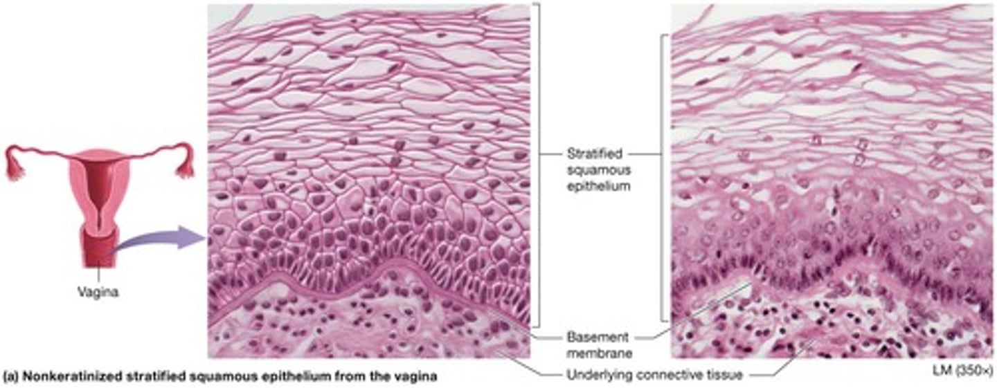 <p>Has 2 types: Keratinized and Nonkeratinized.</p>