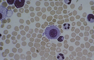 normal cell