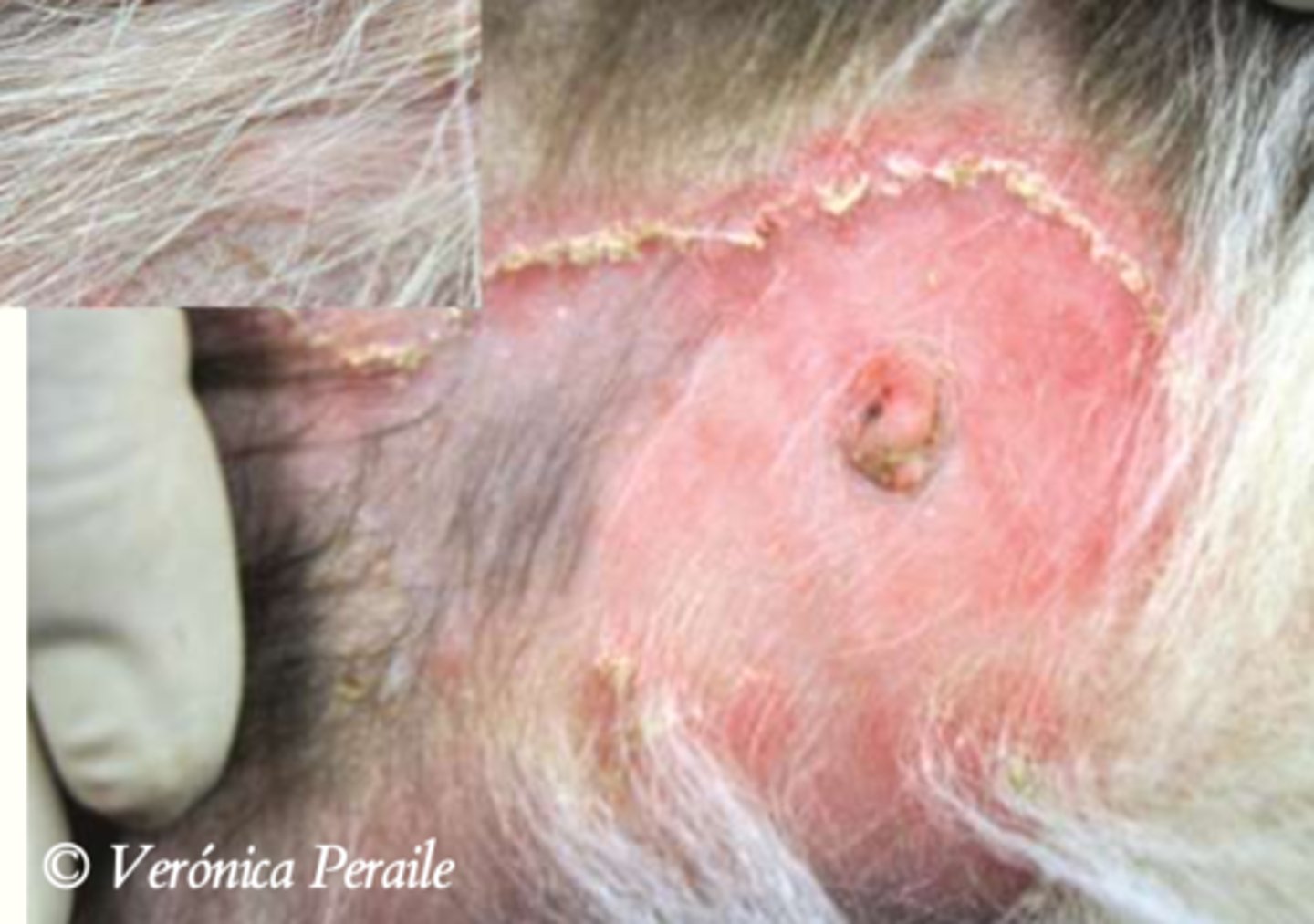 <p>¿lesión?</p><p>¿primaria o secundaria?</p>