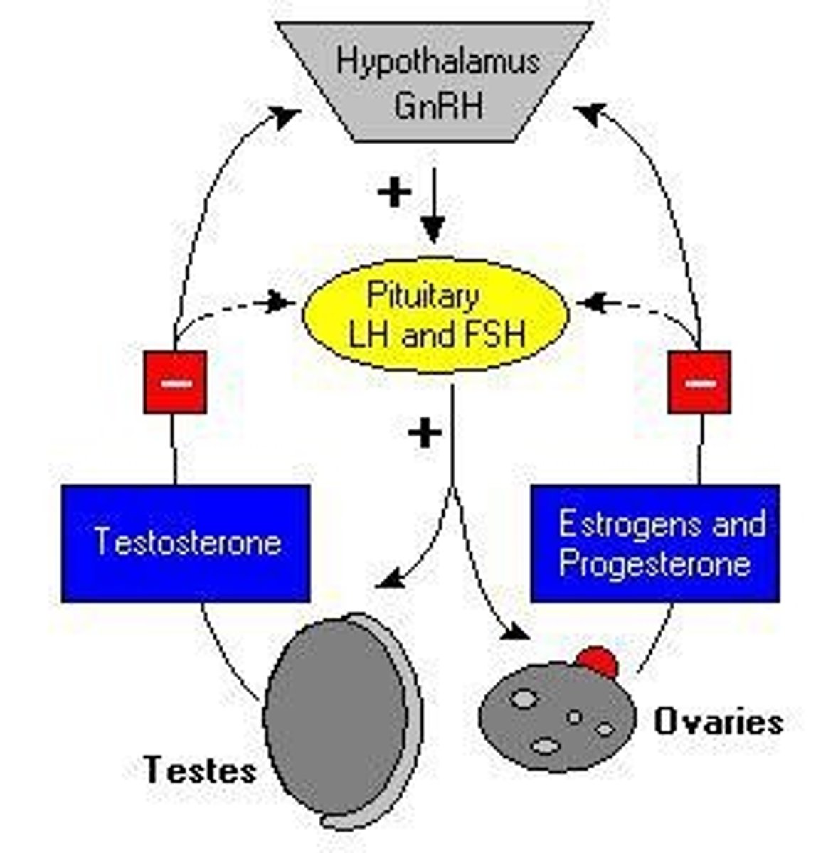 <p>Type I is juvenile onset, often due to an immune disorder; Type II is mature onset, often related to obesity.</p>
