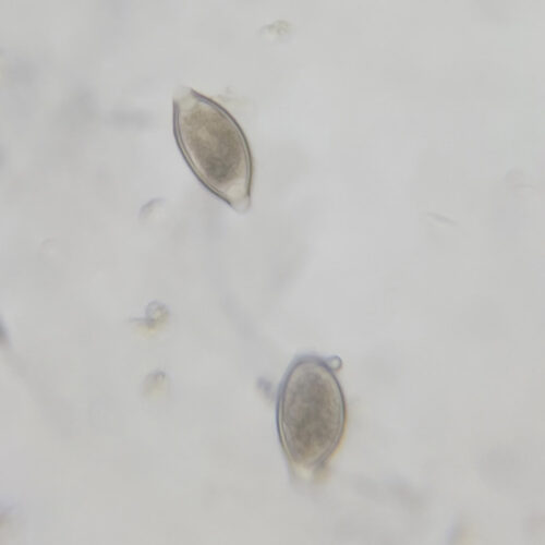 <p>Whipworm eggs</p><p>Humans and primates </p>
