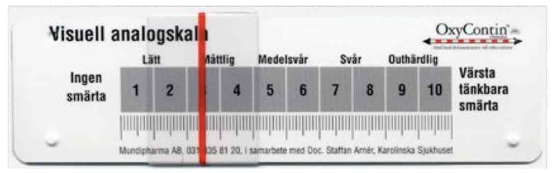 <p>Med självrapporter (t.ex. VAS) och Multidimensional Pain Inventory (MPI, formulär med ca 100 frågor i tre stora delar)</p>