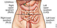 <ul><li><p>right upper quad RUQ</p></li><li><p>left upper quad LUQ</p></li><li><p>right lower quad RLQ</p></li><li><p>left lower quad LLQ</p></li></ul><p></p>