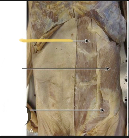 <p>Identify the highlighted muscle</p>