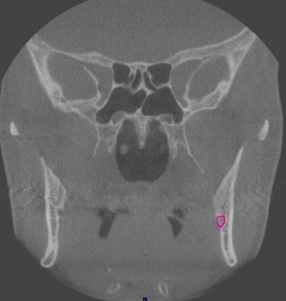 <p>where is this slice </p>