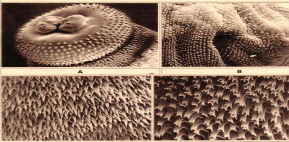 <p>Parasite under microscope </p>