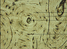 <ul><li><p><span style="background-color: transparent; font-family: "Book Antiqua", serif;"><span>Circular like tree rings</span></span></p></li><li><p><span style="background-color: transparent; font-family: "Book Antiqua", serif;"><span>Cells sit in a lacuna</span></span></p></li><li><p><span style="background-color: transparent; font-family: "Book Antiqua", serif;"><span>Central haversian canal</span></span></p></li><li><p><span style="background-color: transparent; font-family: "Book Antiqua", serif;"><span>Matrix made of calcium and phosphorus salts</span></span></p></li></ul><p></p>
