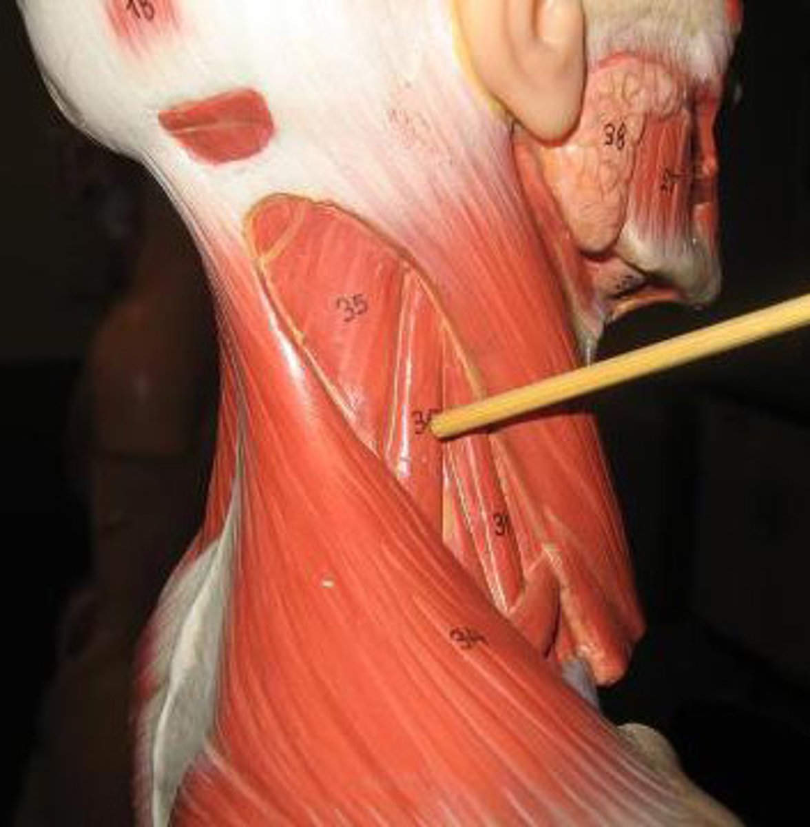<p>elevates scapula</p>