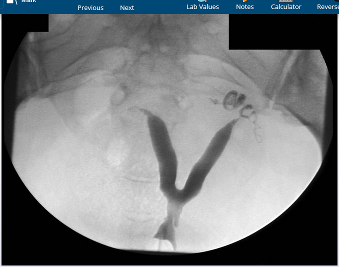 <p>what is she at greatest risk for during pregnancy?</p>