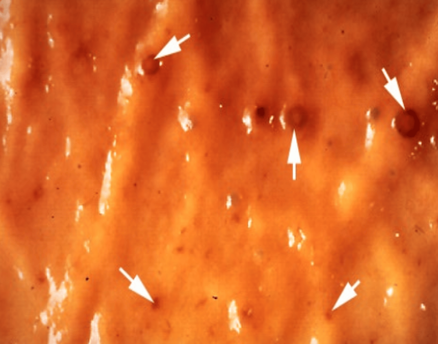 <p>small nodules in the wall of the caecum of a horse. what parasite do we expect this to be?</p>