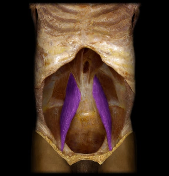 <p>IDENTIFY THIS MUSCLE</p>