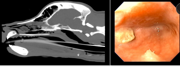 <p><span>Nasopharyngeal Stenosis</span></p>