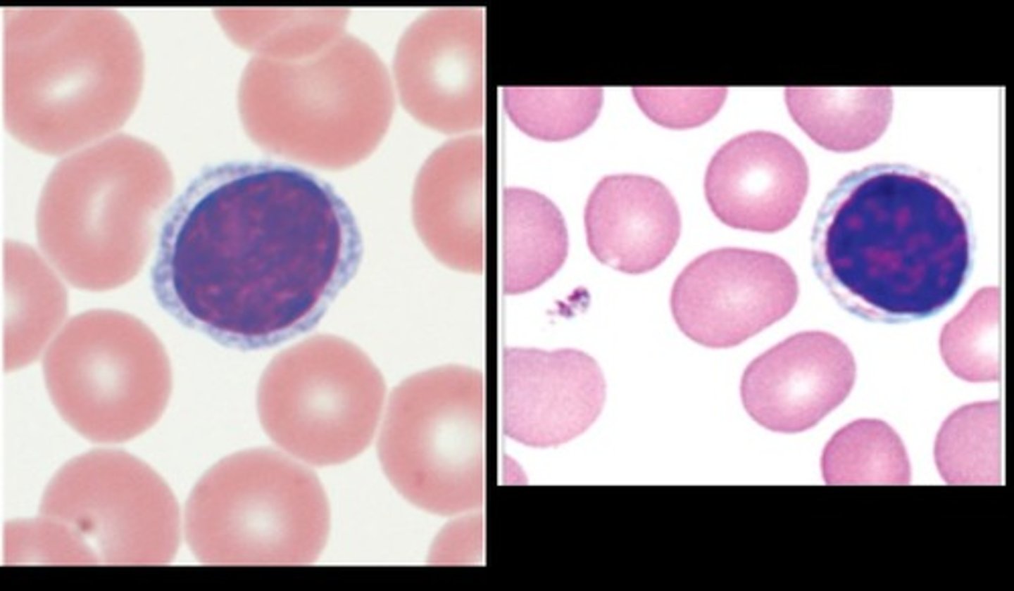 <p>T cells, B cells, Natural killer cells</p><p>Have a halo effect/ring around the nucleus</p>
