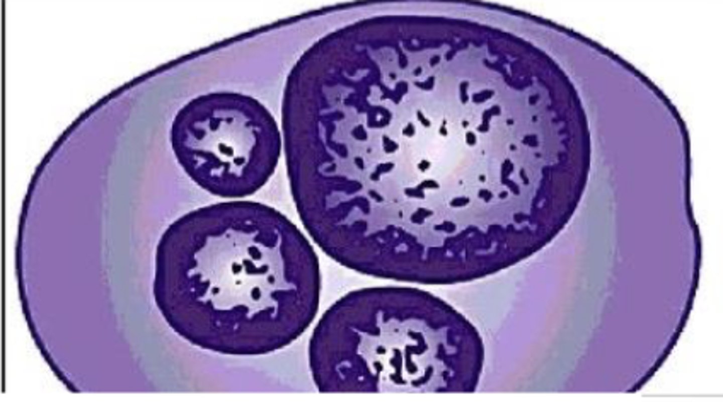 <p>What is the term used for multiple nuclei in a cell; especially important if the nuclei vary in size</p>