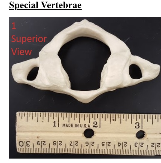 <p>1) name this specific vertebra </p>