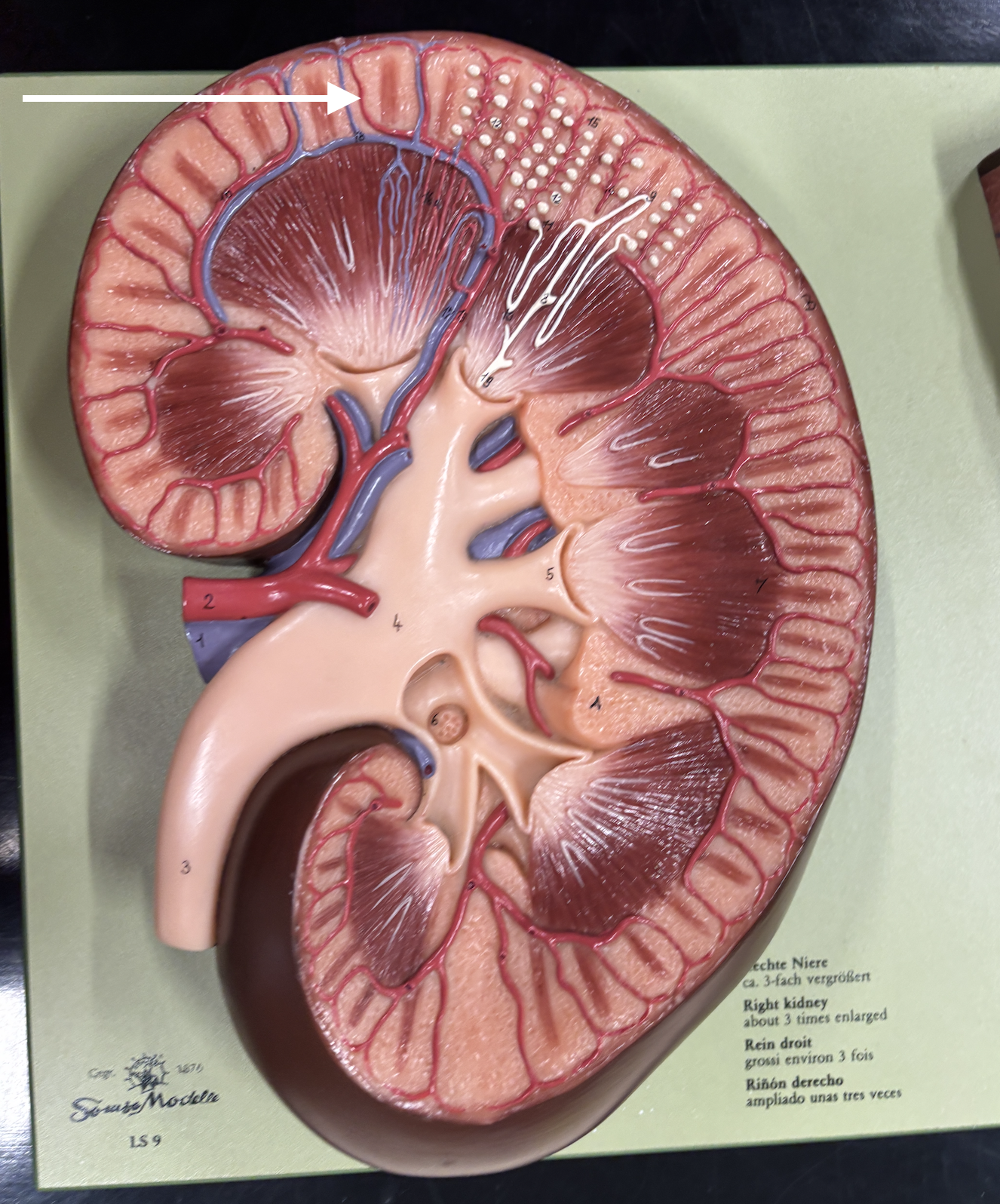 <p>what structure is the arrow pointing to? *artery*</p>