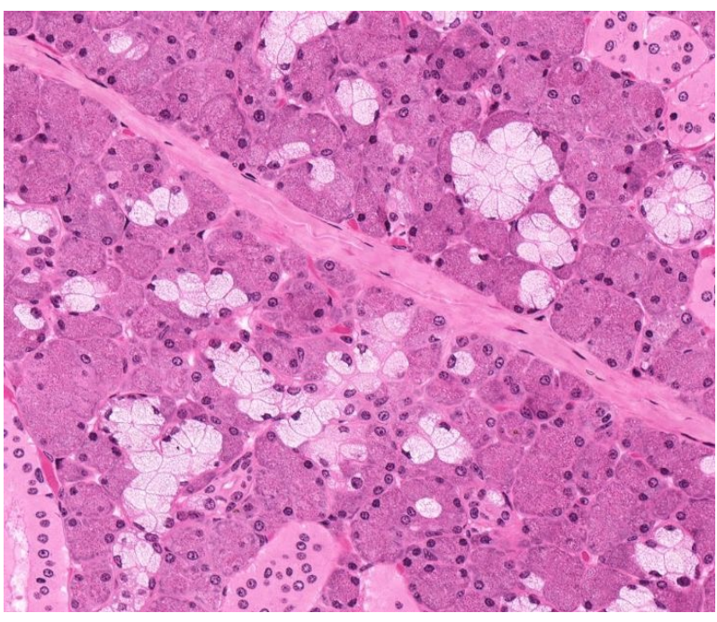 <p>what gland is this </p>