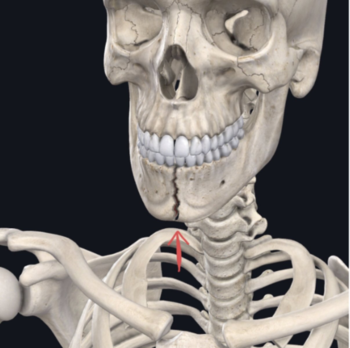 <p>Identify the plane of section in which the indicated fracture has occurred.</p>