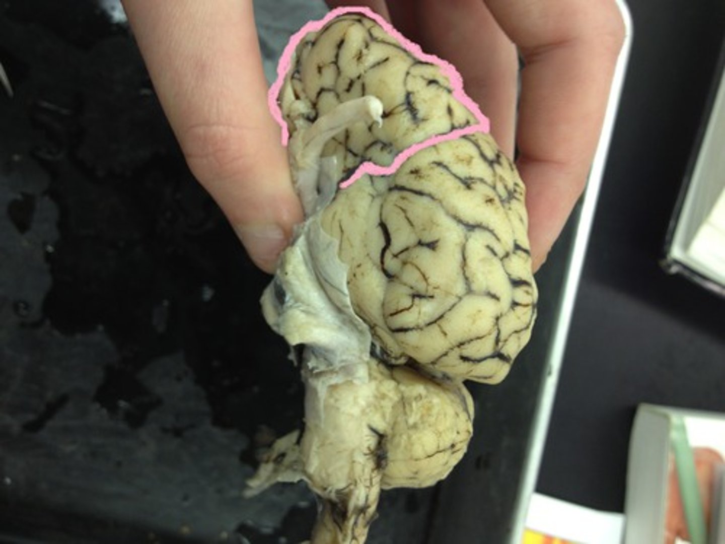 <p>A lobe of the cerebrum that has specialized areas for skeletal muscle movement (motor cortex), abstract thinking, planning, memory, and judgement</p>