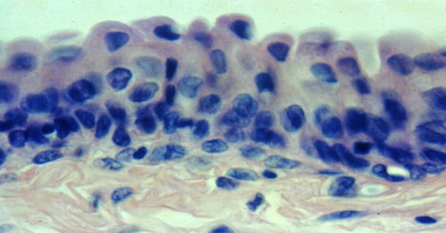 <p>What is the function of the transitional epithelium tissue?</p>