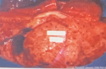 <p>σ</p>