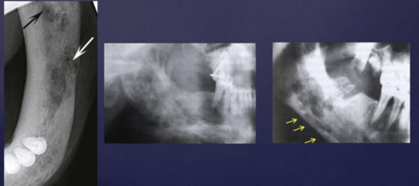 <p>These arrows are pointing at what?</p>