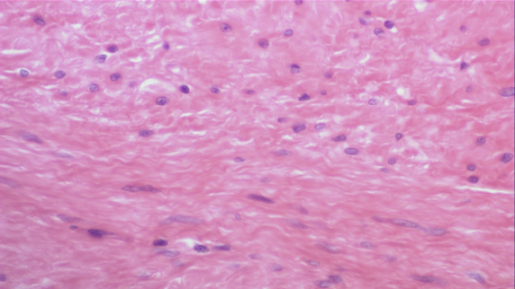 <p>Non-striated Involuntary muscle</p><p></p><p>Found in 2 forms</p><ul><li><p>Visceral (stomach/intestines)</p><ul><li><p>Large sheets of cells in walls of hollow organs</p></li></ul></li><li><p>Multiunit (iris)</p><ul><li><p>Small discrete groups of cells</p></li></ul></li></ul><p></p>