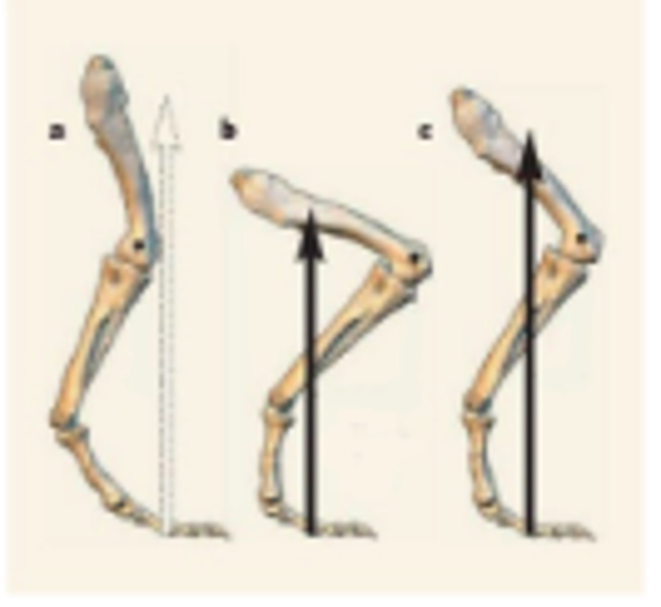 <p>In the figure below, which of the following situations has the longest moment arm for the knee?<br>A, B, or C?</p>