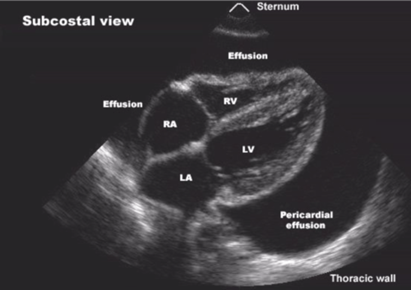 <p>An ultrasound of the heart.</p>