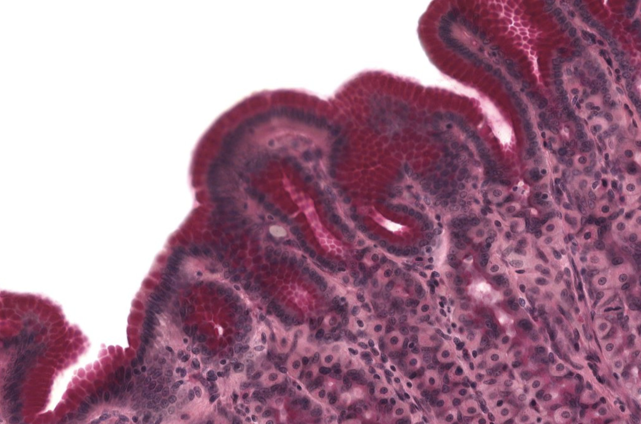 <p>Gastric Pits in Fundic Stomach </p>