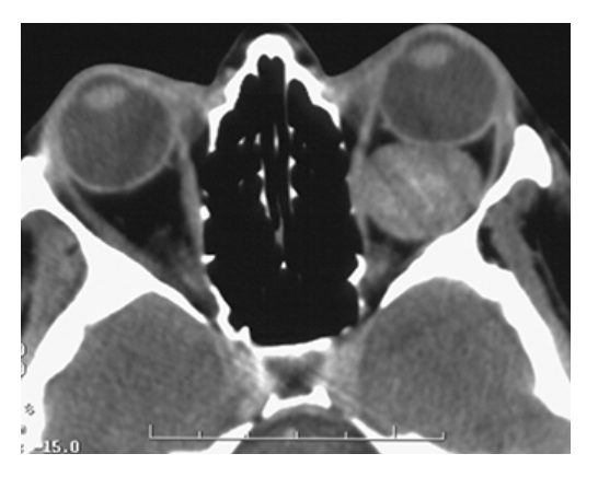 <p>What does the figure show?</p>