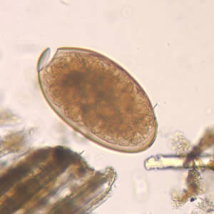<p>The large, operculate egg shown below is characteristic of:<br><br>Heterophyes heterophyes</p><p>Diphyllobothrium latum</p><p>Fasciola hepatica</p><p>Paragonimus westermani</p><p>Clonorchis sinensis</p>