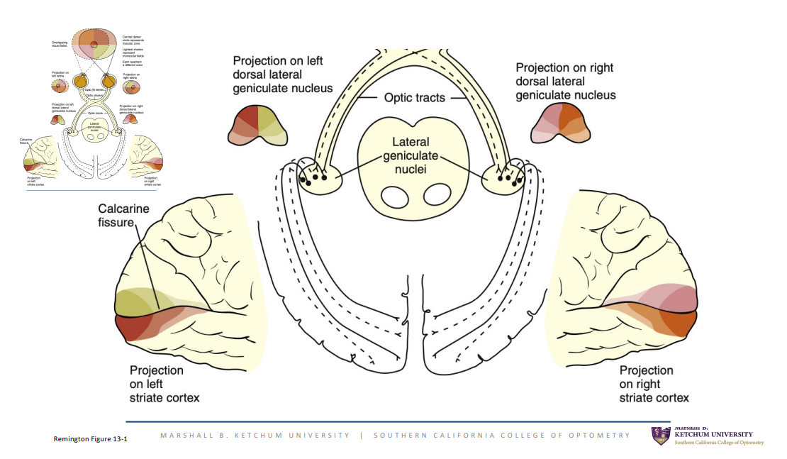 <p>Inferior radiations terminate in the region below the calcarine sulcus called the lingual gyrus • Superior radiations terminate in the region above the calcarine sulcus called the cuneus gyrus • Fibers from the macular area terminate posteriorly in the visual cortex • Fibers from the nasal periphery terminate in the most anterior part of the visual cortex near the parietal lobe. This corresponds to the temporal crescent in the visual field seen by only the contralateral eye • Mapping of the visual cortex demonstrated that the central portion of the visual field occupies the majority of the striate cortex</p>
