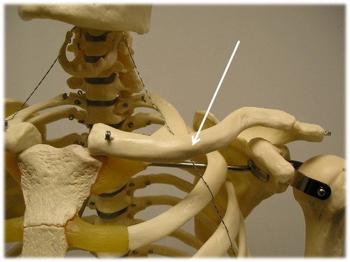 <p>- manubrium of the sternum (medial end of clavicle) </p><p>- acromion of the scapula (lateral end of clavicle)</p>