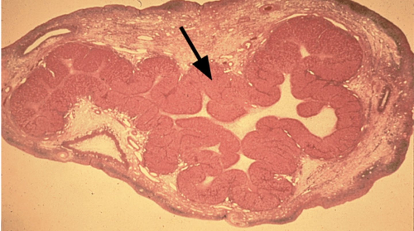 <p>What is the black arrow</p>