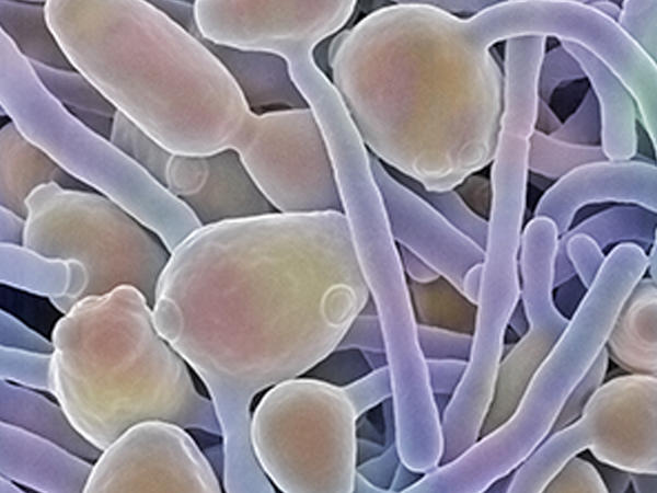 <p>Eukaryotic organisms with cell walls that decompose dead matter and return chemical elements to the environment.</p>