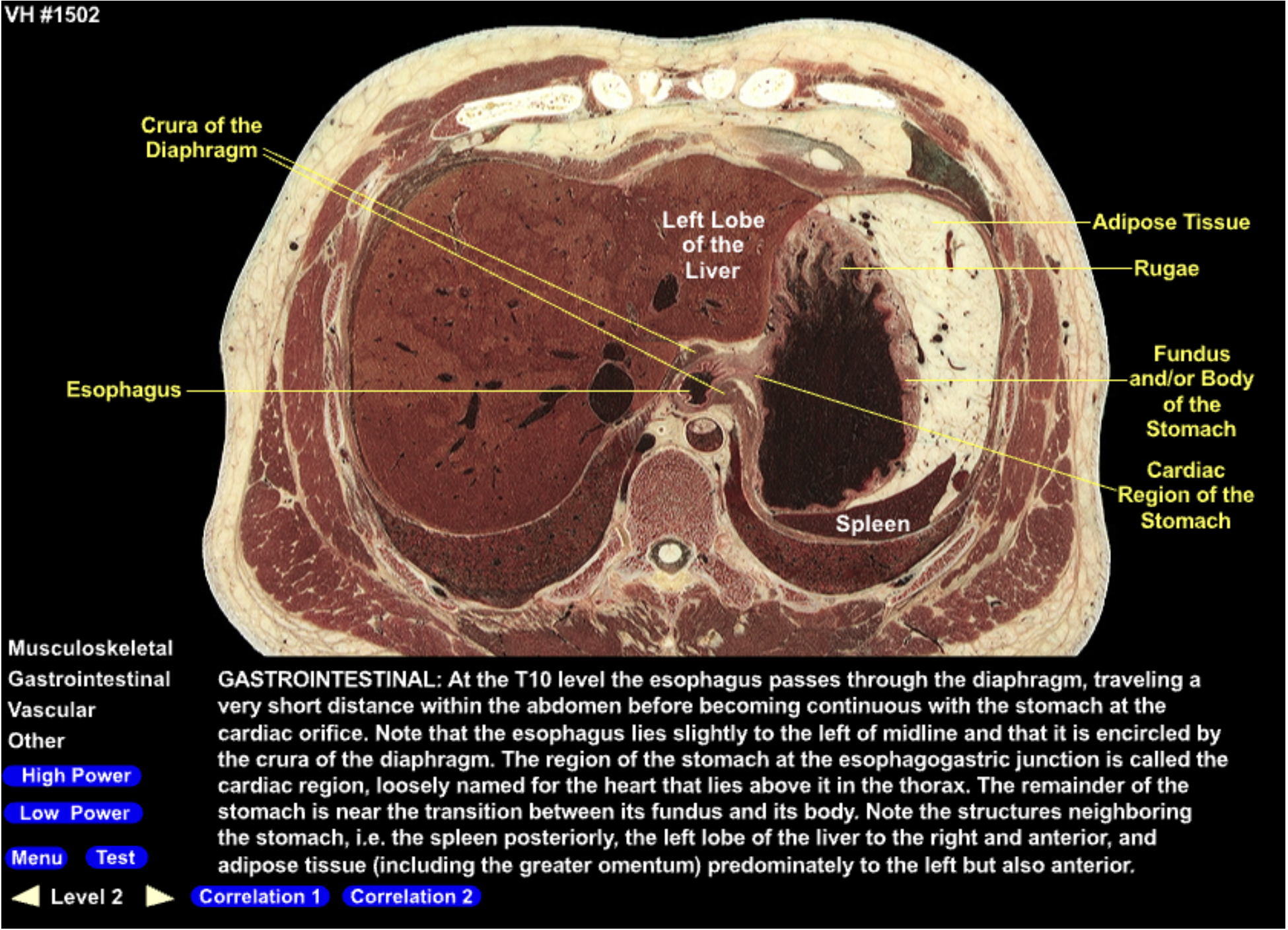 knowt flashcard image