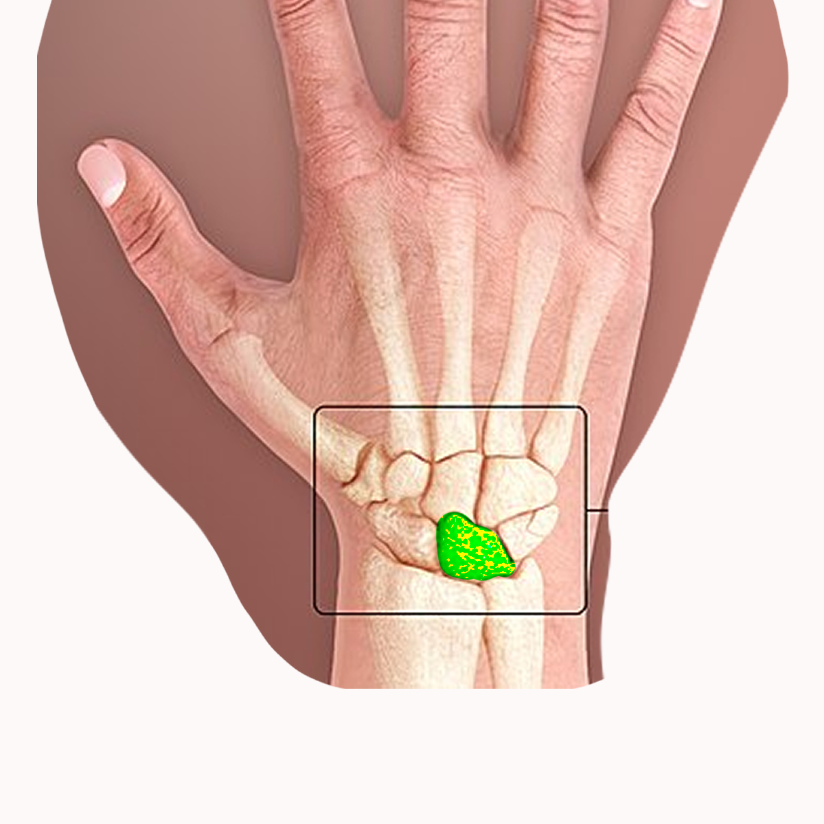 <p>Name the highlighted carpal</p>