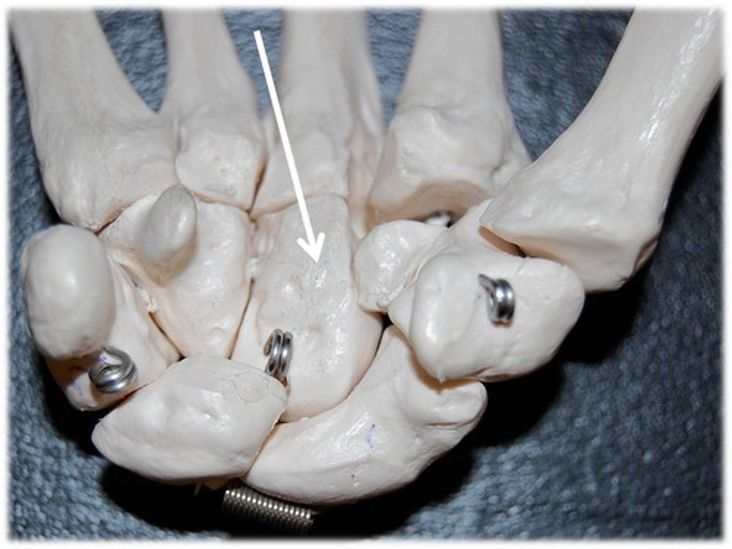 <p>Name this carpal bone (anterior view).</p>