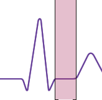 <p>What is the highlighted section</p>